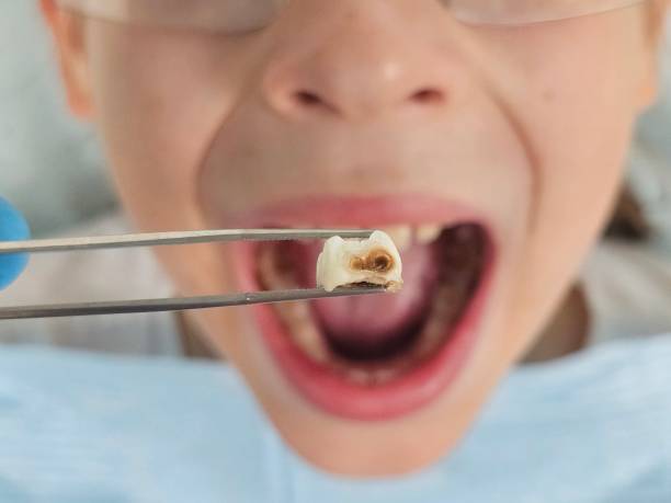 Best Emergency Treatment for Toothache in Georgetown, KY