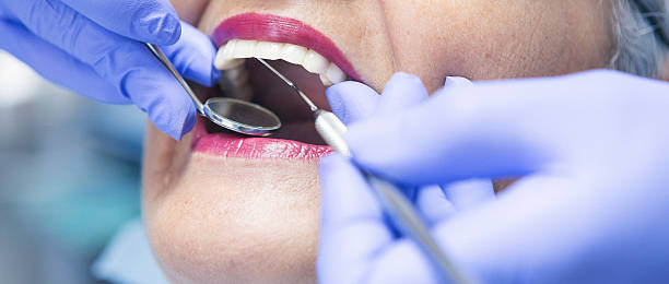 Best Emergency Treatment for Toothache in Georgetown, KY